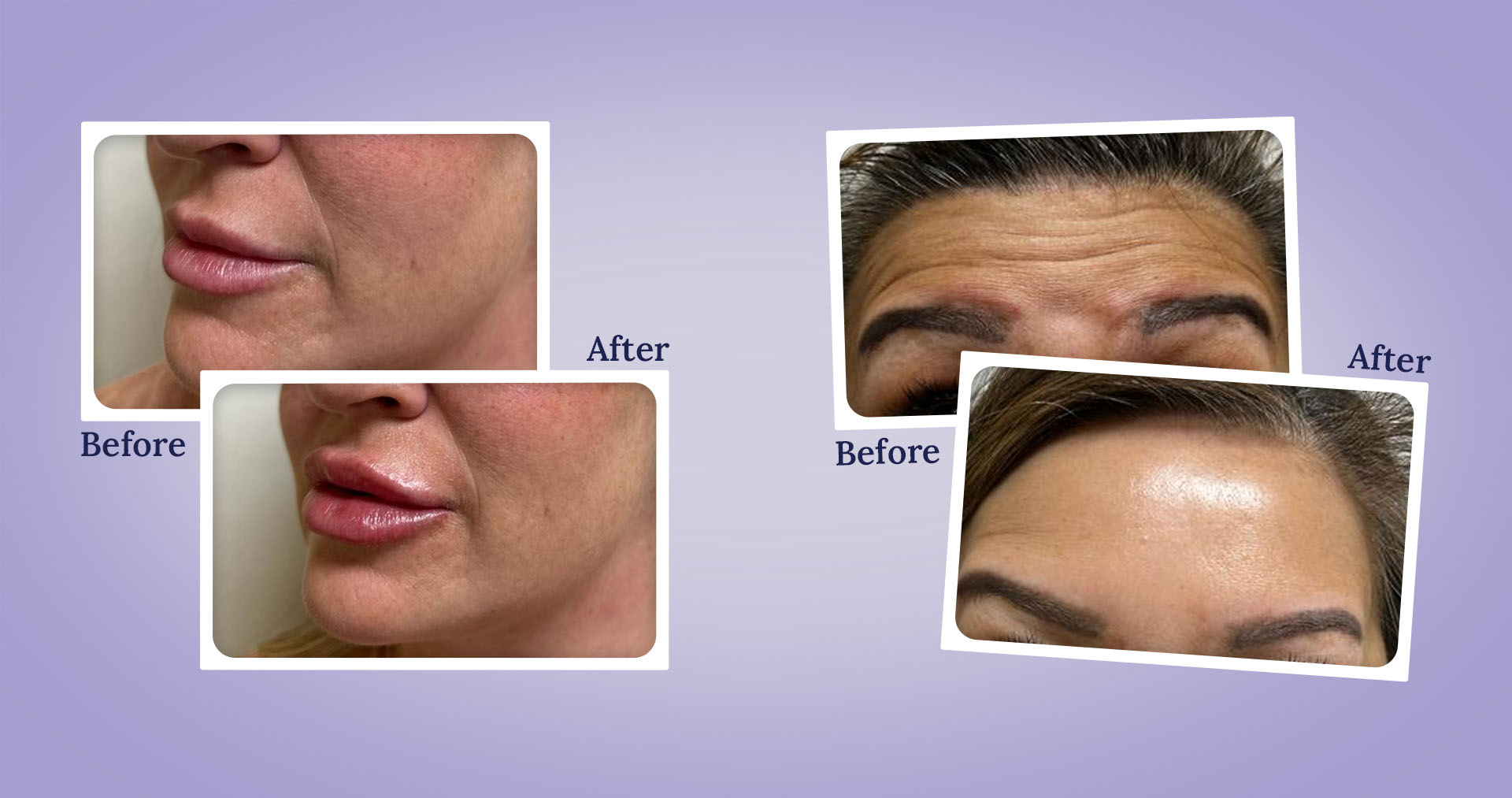 medical spa las vegas