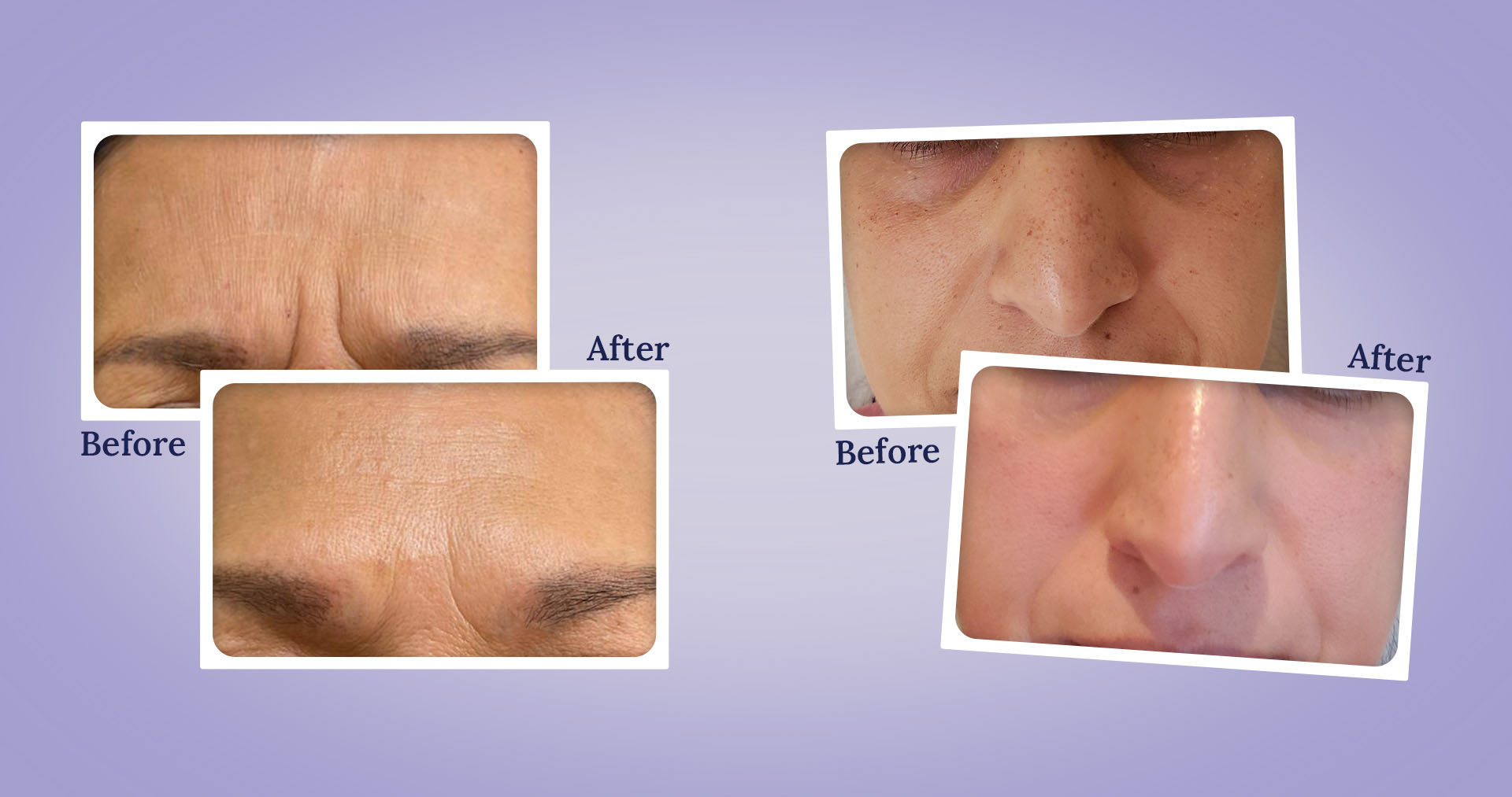 medical spa las vegas