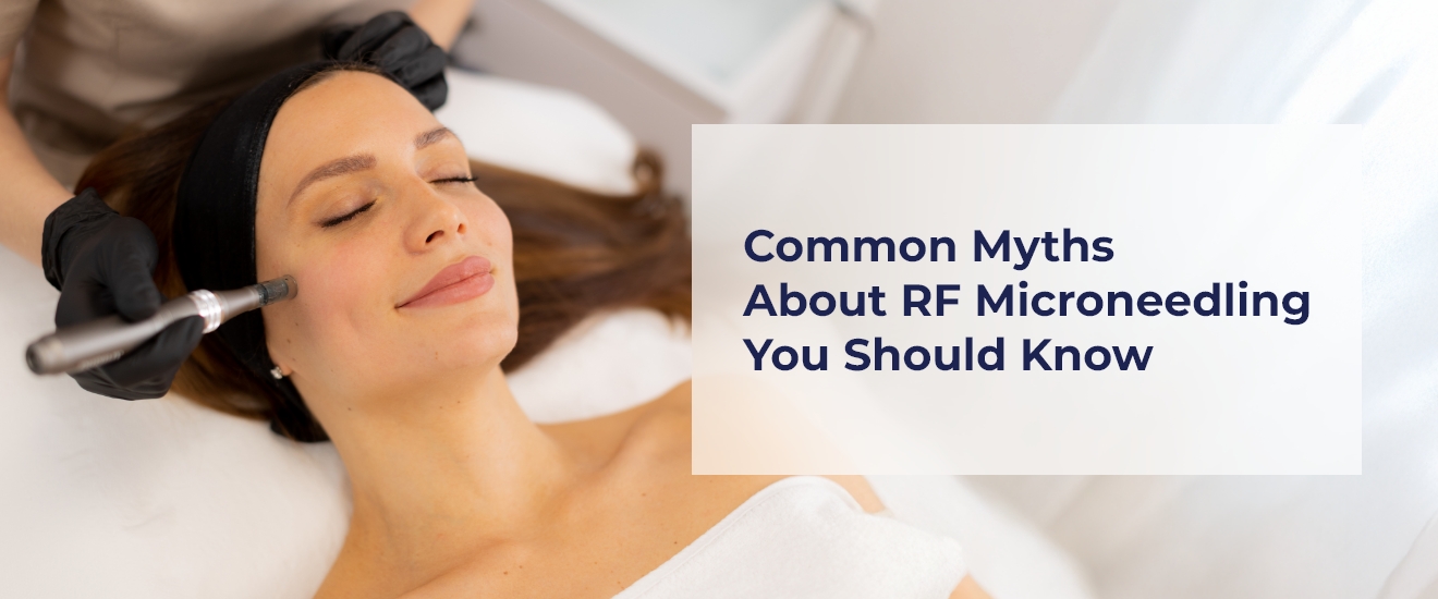 Common Myths About RF Microneedling